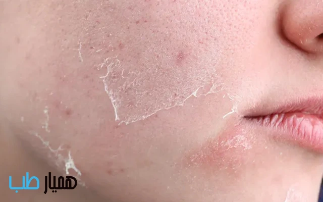 تاثیر هیدراتاسیون در سلامت پوست3