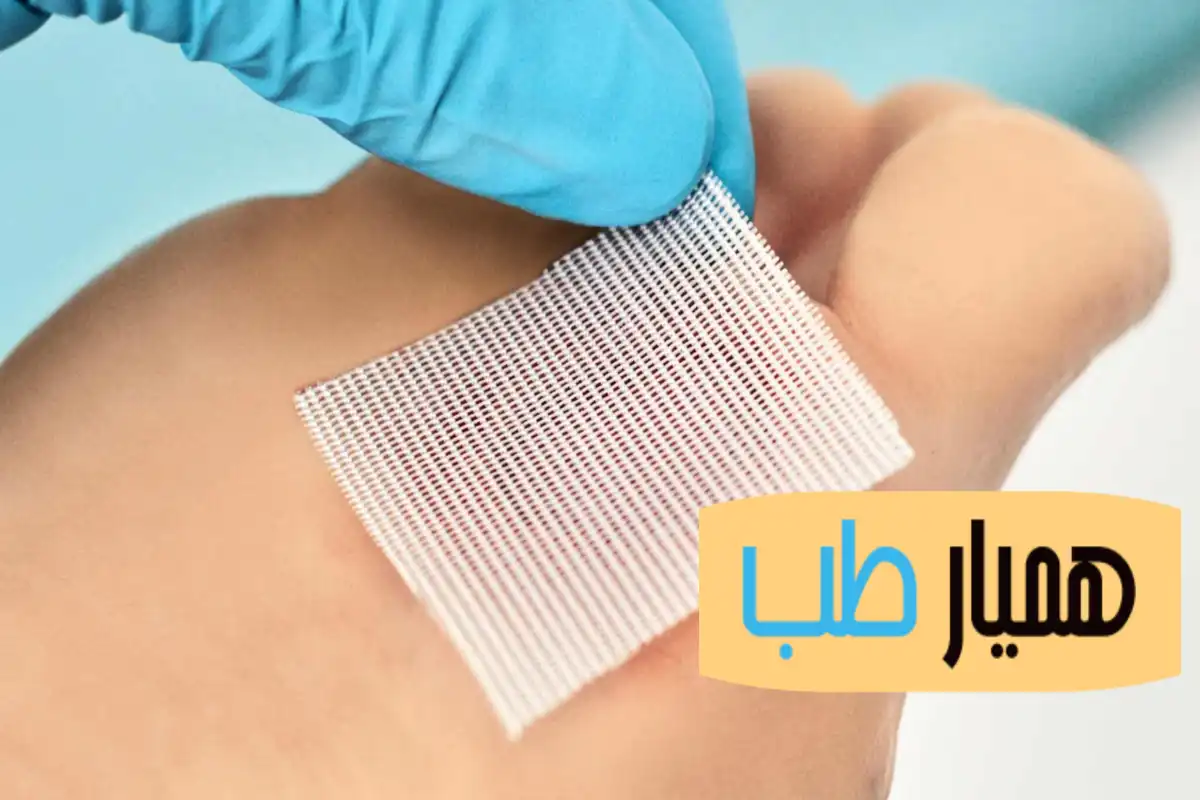 پانسمان نقره نوین