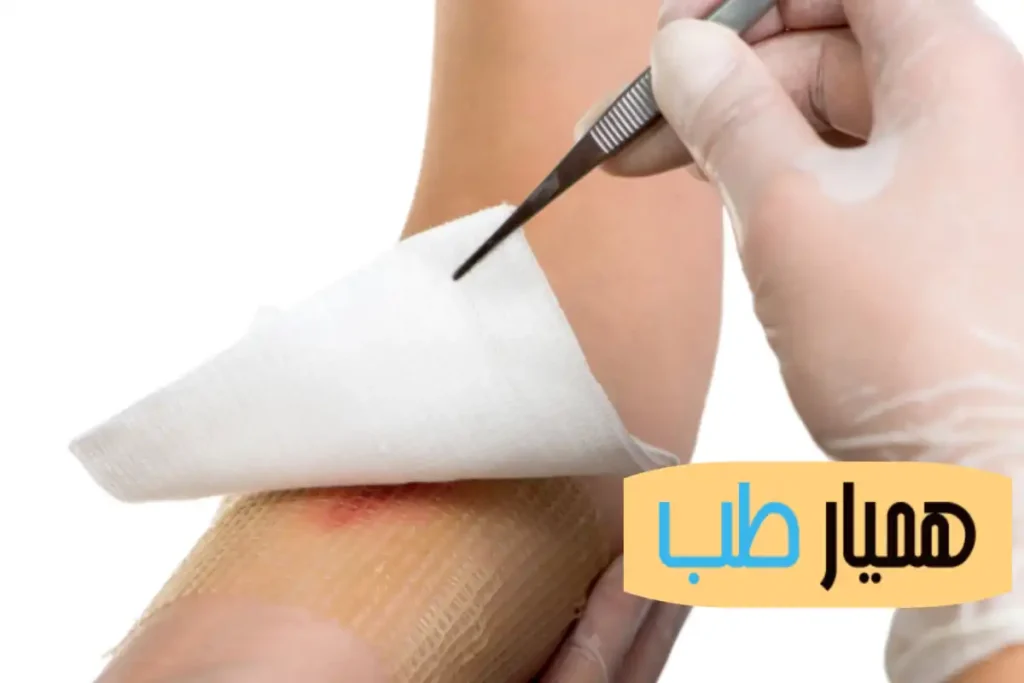 10 اشتباه رایج و خطرناک در رابطه با پانسمان زخم