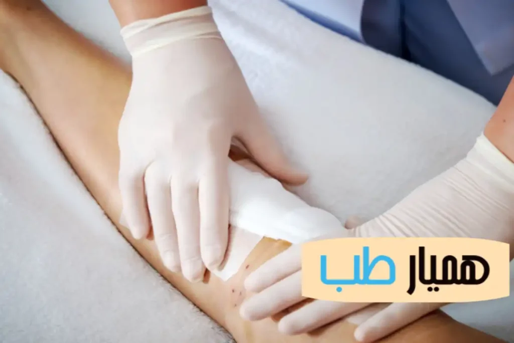 پانسمان نوین برای زخم‌ مزمن و عفونی | آیا با پانسمان نوین می‌توان زخم‌های مزمن و عفونی را مدیریت کرد؟