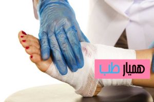 پانسمان نوین زخم پای دیابتی