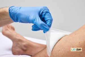 پانسمان آلژینات کلسیم