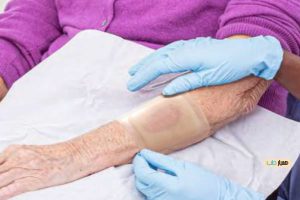 پانسمان زخم عمیق 